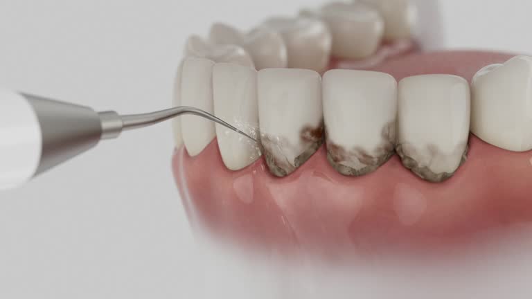 Reliable Dental contractor in Washburn, IL by Dentist Open Now